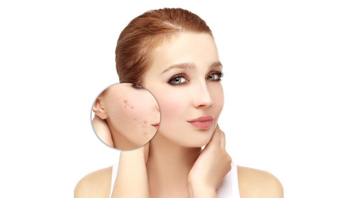 Skin Care Tips To Fight Pigmentation
