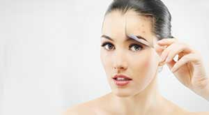 10 Home Remedies on How to Get Rid Of Acne Scars