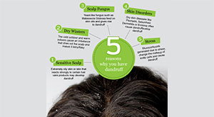 5 Reasons Why You Have Dandruff