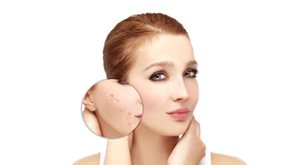 Skin Care Tips To Fight Pigmentation