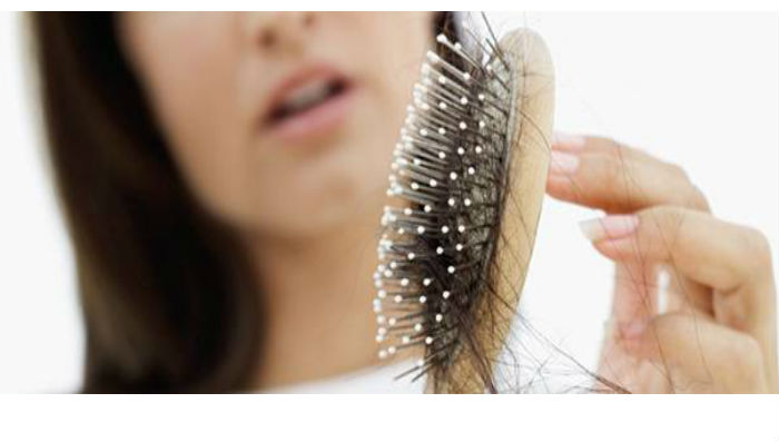 Home Remedies to Prevent Dandruff